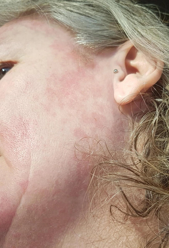 mvskintherapy.co.uk